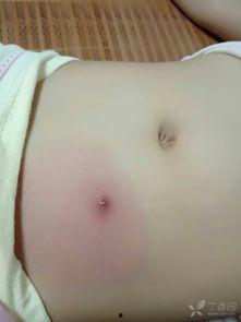 下腹部消毒视频,下腹部消毒操作步骤详解